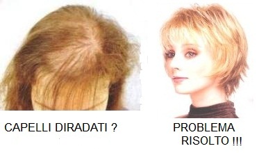 2 alopecia.jpg